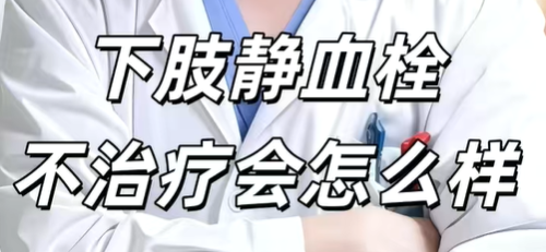 下肢静脉血栓，不治疗会怎么样！