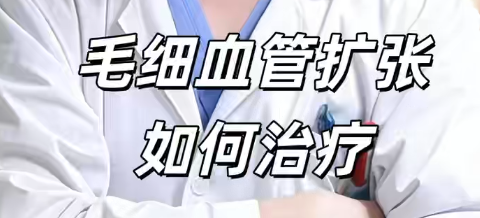 《毛细血管扩张如何治疗》