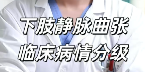 《下肢静脉曲临床病情分级》